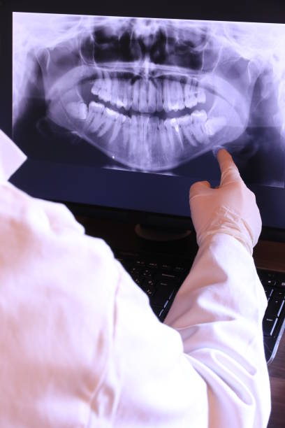Best Knocked-Out Tooth Emergency  in Medina, NY