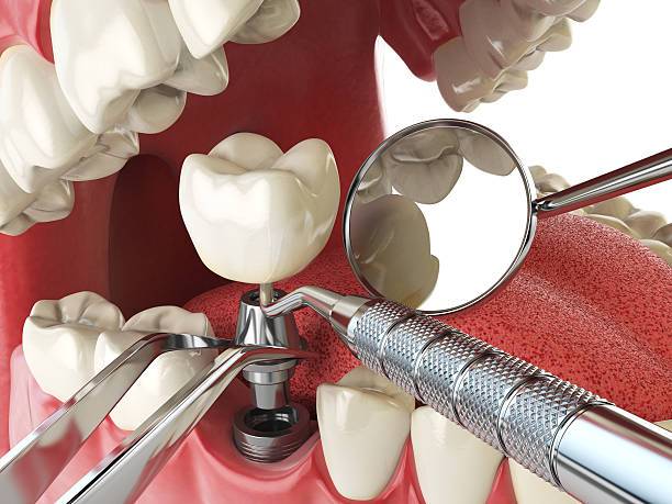 Best Cracked Tooth Emergency Dentist  in Medina, NY